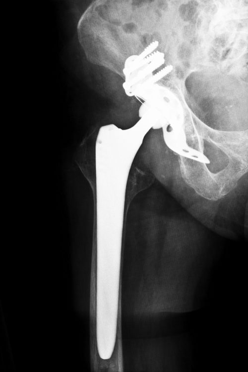 Machines for Medical Implant and Parts Manufacturing