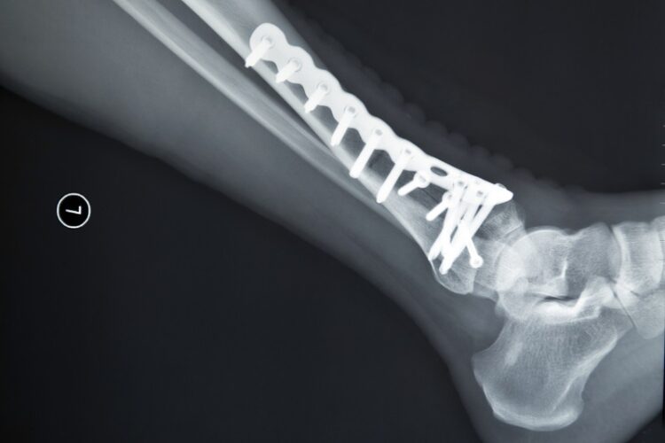 CNC Machines for Medical Industry